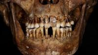 Ijesztő titka volt a 17. századi arisztokratának a fogai megőrzésére